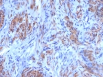 IHC staining of FFPE human uterus tissue with SMMHC antibody (clone SM-M10). HIER: boil tissue sections in pH 9 10mM Tris with 1mM EDTA for 20 min and allow to cool before testing.