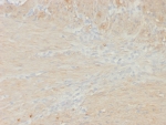 IHC staining of FFPE colon smooth muscle tissue with recombinant MYH11 antibody (clone rMYH11/8066). HIER: boil tissue sections in pH 9 10mM Tris with 1mM EDTA for 20 min and allow to cool before testing.