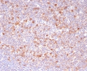 IHC staining of FFPE human tonsil tissue with B-cell maturation protein antibody (clone CD269/8190R). HIER: boil tissue sections in pH 9 10mM Tris with 1mM EDTA for 20 min and allow to cool before testing.