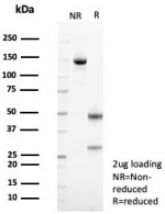 SDS-PAGE analysis of purified, BSA-free recombinant Mesothelin antibody (clone MSLN/8391R) as confirmation of integrity and purity.