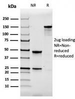 SDS-PAGE analysis of purified, BSA-free recombinant TPSAB1 antibody (clone rTPSAB1/1963) as confirmation of integrity and purity.