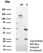 SDS-PAGE analysis of purified, BSA-free Matrix metalloproteinase 2 antibody (clone MMP2/4586) as confirmation of integrity and purity.