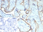IHC staining of FFPE human placental tissue with Matrix metalloproteinase 2 antibody (clone MMP2/4586). Inset: PBS used in place of primary Ab (secondary Ab negative control). HIER: boil tissue sections in pH 9 10mM Tris with 1mM EDTA for 20 min and allow to cool before testing.