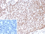 IHC staining of FFPE human lymph node tissue with E2F4 antibody (clone E2F4/4224). Inset: PBS used in place of primary Ab (secondary Ab negative control). HIER: boil tissue sections in pH 9 10mM Tris with 1mM EDTA for 20 min and allow to cool before testing.
