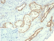 IHC staining of FFPE human kidney tissue with recombinant CDH16 antibody (clone rCDH16/7342) at 2ug/ml. Inset: PBS used in place of primary Ab (secondary Ab negative control). HIER: boil tissue sections in pH 9 10mM Tris with 1mM EDTA for 20 min and allow to cool before testing.