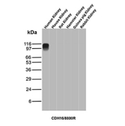 Ksp-Cadherin Antibody Human Kidney WB. Western blot analysis of Cadherin-16 / CDH16, also known as Ksp-Cadherin, expression across kidney tissue lysates from multiple species using Ksp-Cadherin antibody clone CDH16/8800R. Lane 1: human kidney lysate, Lane 2: mouse kidney lysate, Lane 3: rat kidney lysate, Lane 4: hamster kidney lysate, Lane 5: guinea pig kidney lysate, Lane 6: rabbit kidney lysate. A band is detected at approximately 95-110 kDa in human kidney lysate, consistent with the predicted molecular weight of Ksp-Cadherin (CDH16), with the slightly higher apparent migration reflecting glycosylation of this kidney-restricted adhesion protein. Minimal or no detectable signal is observed in the non-human kidney lysates under these conditions, supporting a human kidney-enriched detection profile for this clone.