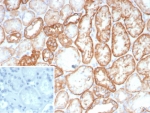 IHC staining of FFPE human kidney tissue with Ksp-Cadherin antibody (clone CDH16/8800R) at 2ug/ml. Inset: PBS used in place of primary Ab (secondary Ab negative control). HIER: boil tissue sections in pH 9 10mM Tris with 1mM EDTA for 20 min and allow to cool before testing.