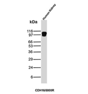 Ksp-Cadherin Antibody Human Kidney WB. Western blot analysis of Cadherin-16 / CDH16, also known as Ksp-Cadherin, expression in human kidney tissue lysate using Ksp-Cadherin antibody clone CDH16/8800R. Lane 1: human kidney lysate. A band is detected at approximately 95-110 kDa, consistent with the predicted molecular weight of Ksp-Cadherin (CDH16), with the slightly higher apparent migration reflecting glycosylation of this kidney-restricted adhesion protein. The strong signal in human kidney lysate supports a human kidney-enriched detection profile for this clone and aligns with the restricted expression of CDH16 in renal epithelial tissue.