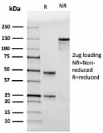 SDS-PAGE analysis of purified, BSA-free TP53 antibody (clone rTP53/3889) as confirmation of integrity and purity.