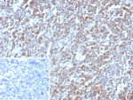 IHC staining of FFPE human tonsil tissue with E2F4 antibody (clone E2F4/8984R). Inset: PBS used in place of primary Ab (secondary Ab negative control). HIER: boil tissue sections in pH 9 10mM Tris with 1mM EDTA for 20 min and allow to cool before testing.