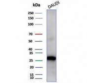 Western blot testing of human Daudi cell lysate with Haptoglobin antibody (clone HP/4813). Predicted molecular weight: 35-40 kDa (beta chain), 45-50 kDa (alpha + beta chain).