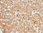 IHC staining of FFPE human liver tissue with Haptoglobin antibody (clone HP/3832). HIER: boil tissue sections in pH 9 10mM Tris with 1mM EDTA for 20 min and allow to cool before testing.