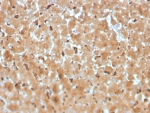 IHC staining of FFPE human liver tissue with Haptoglobin antibody (clone HP/3834). HIER: boil tissue sections in pH 9 10mM Tris with 1mM EDTA for 20 min and allow to cool before testing.
