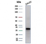 Western blot testing of human Daudi cell lysate with Haptoglobin (HP) antibody (clone HP/3834). Predicted molecular weight: 35-40 kDa (beta chain), 45-50 kDa (alpha + beta chain).