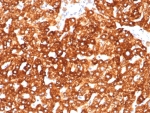 IHC staining of FFPE human liver tissue with Haptoglobin antibody (clone HP/3838). HIER: boil tissue sections in pH 9 10mM Tris with 1mM EDTA for 20 min and allow to cool before testing.