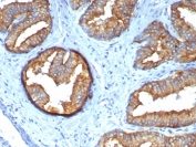IHC staining of FFPE prostate tissue with Beta Tubulin antibody (clone TUBB/4470). HIER: boil tissue sections in pH 9 10mM Tris with 1mM EDTA for 20 min and allow to cool before testing.