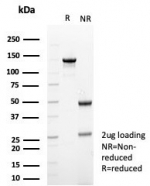 SDS-PAGE analysis of purified, BSA-free recombinant TUBB3 antibody (clone rTUBB3/7405) as confirmation of integrity and purity.