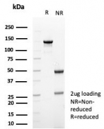 SDS-PAGE analysis of purified, BSA-free recombinant TUBB3 antibody (clone rTUBB3/7405) as confirmation of integrity and purity.