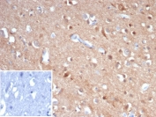 IHC staining of FFPE human brain tissue with TUBB3 antibody (clone rTUBB3/7406). Inset: PBS used in place of primary Ab (secondary Ab negative control). HIER: boil tissue sections in pH 9 10mM Tris with 1mM EDTA for 20 min and allow to cool before testing.
