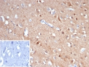 IHC staining of FFPE human brain tissue with TUBB3 antibody (clone rTUBB3/7406). Inset: PBS used in place of primary Ab (secondary Ab negative control). HIER: boil tissue sections in pH 9 10mM Tris with 1mM EDTA for 20 min and allow to cool before testing.