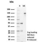 SDS-PAGE analysis of purified, BSA-free recombinant TP53 antibody (clone rTP53/8993) as confirmation of integrity and purity.