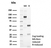 SDS-PAGE analysis of purified, BSA-free Cytokeratin 14 antibody (clone KRT14/6987R) as confirmation of integrity and purity.