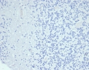 Negative control: IHC testing of FFPE human brain tissue with Cytokeratin 14 antibody (clone KRT14/6987R) at 2ug/ml. HIER: boil tissue sections in pH 9 10mM Tris with 1mM EDTA for 20 min and allow to cool before testing.