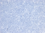 Negative control: IHC testing of FFPE human brain tissue with recombinant ErbB2 antibody (clone rERBB2/6637) at 2ug/ml. HIER: boil tissue sections in pH 9 10mM Tris with 1mM EDTA for 20 min and allow to cool before testing.