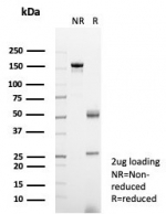 SDS-PAGE analysis of purified, BSA-free GCSF antibody (clone CSF3/4594) as confirmation of integrity and purity.