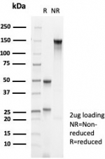 SDS-PAGE analysis of purified, BSA-free CK10 antibody (clone KRT10/6961) as confirmation of integrity and purity.