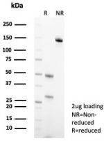 SDS-PAGE analysis of purified, BSA-free Keratin 10 antibody (clone KRT10/3861) as confirmation of integrity and purity.