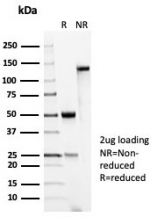 SDS-PAGE analysis of purified, BSA-free recombinant p53 antibody (clone TP53/7082R) as confirmation of integrity and purity.