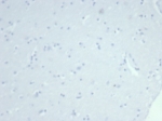 Negative control: IHC testing of FFPE human brain tissue using recombinant KRT14 antibody (clone rKRT14/7368) at 2ug/ml. HIER: boil tissue sections in pH 9 10mM Tris with 1mM EDTA for 20 min and allow to cool before testing.