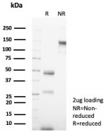 SDS-PAGE analysis of purified, BSA-free CK14 antibody (clone rKRT14/7290) as confirmation of integrity and purity.