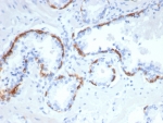 IHC staining of FFPE human prostate tissue with CK14 antibody (clone rKRT14/7290). HIER: boil tissue sections in pH 9 10mM Tris with 1mM EDTA for 20 min and allow to cool before testing.