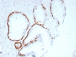 IHC staining of FFPE human prostate tissue with Cytokeratin 14 antibody (clone rKRT14/8692) at 2ug/ml. HIER: boil tissue sections in pH 9 10mM Tris with 1mM EDTA for 20 min and allow to cool before testing.