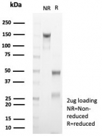 SDS-PAGE analysis of purified, BSA-free recombinant KRT10 antibody (clone rKRT10/6923) as confirmation of integrity and purity.