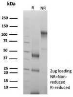 SDS-PAGE analysis of purified, BSA-free Acidic Cytokeratin antibody (clone rKRTL/8751) as confirmation of integrity and purity.