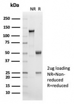 SDS-PAGE analysis of purified, BSA-free Cytokeratin 14 antibody (clone KRT14/7047R) as confirmation of integrity and purity.