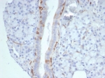 IHC staining of FFPE human prostate tissue with Cytokeratin 14 antibody (clone KRT14/7047R). HIER: boil tissue sections in pH 9 10mM Tris with 1mM EDTA for 20 min and allow to cool before testing.