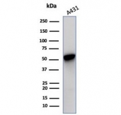 Western blot testing of human A431 cell lysate with recombinant Cytokeratin 14 antibody (clone KRT14/7054R). Predicted molecular weight ~53 kDa.