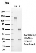 SDS-PAGE analysis of purified, BSA-free recombinant Cytokeratin 14 antibody (clone KRT14/7054R) as confirmation of integrity and purity.