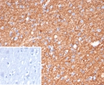 IHC staining of FFPE human brain tissue with GFAP antibody (clone GFAP/6874). Inset: PBS used in place of primary Ab (secondary Ab negative control). HIER: boil tissue sections in pH 9 10mM Tris with 1mM EDTA for 20 min and allow to cool before testing.