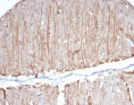 IHC staining of FFPE human brain tissue with GFAP antibody (clone GFAP/6874). HIER: boil tissue sections in pH 9 10mM Tris with 1mM EDTA for 20 min and allow to cool before testing.