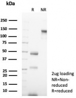 SDS-PAGE analysis of purified, BSA-free recombinant Keratin 14 antibody (clone KRT14/7977R) as confirmation of integrity and purity.