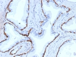 IHC staining of FFPE human prostate tissue with recombinant Keratin 14 antibody (clone KRT14/7977R). HIER: boil tissue sections in pH 9 10mM Tris with 1mM EDTA for 20 min and allow to cool before testing.