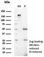 SDS-PAGE analysis of purified, BSA-free Topoisomerase II alpha antibody (clone TOP2A/8103R) as confirmation of integrity and purity.