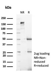 Topoisomerase II alpha Antibody SDS-PAGE (Reducing vs Non-Reducing). SDS-PAGE analysis of Topoisomerase II alpha antibody clone TOP2A/8103R under reducing (R) and non-reducing (NR) conditions, showing expected antibody heavy and light chain band patterns.