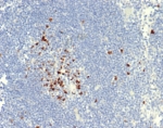 IHC staining of FFPE dog lymph node tissue with Topoisomerase II alpha antibody (clone TOP2A/7169R). HIER: boil tissue sections in pH 9 10mM Tris with 1mM EDTA for 20 min and allow to cool before testing.