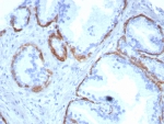 IHC staining of FFPE human prostate tissue with Cytokeratin 14 antibody (clone KRT14/8261R). HIER: boil tissue sections in pH 9 10mM Tris with 1mM EDTA for 20 min and allow to cool before testing.